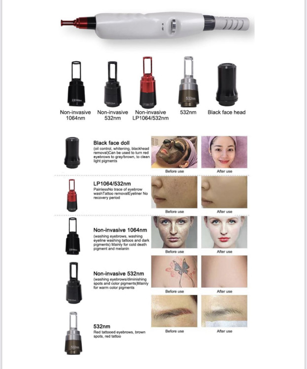 دستگاه لیزر حذف تاتو پیکوثانیه انزو ایتالیا گارانتی دار