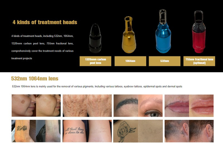 کیوسوئیچ ناب وی رو میزی